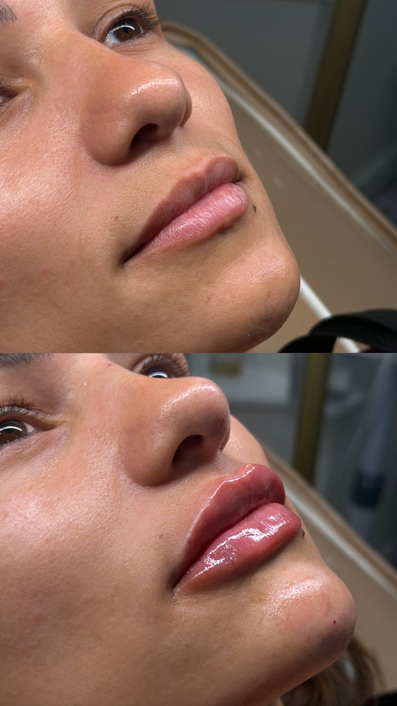 Resultado facial de perfil